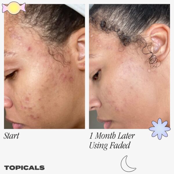 Topicals Faded Serum for Dark Spots & Discoloration