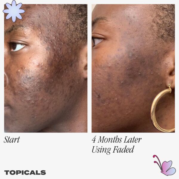 Topicals Faded Serum for Dark Spots & Discoloration