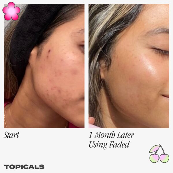 Topicals Faded Serum for Dark Spots & Discoloration