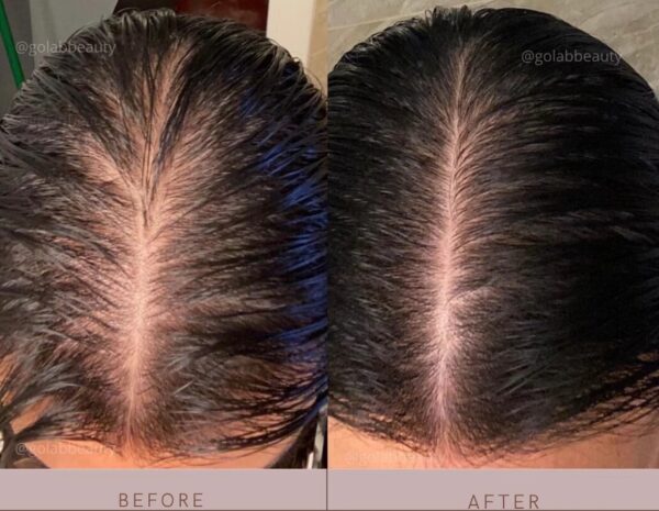 Golab Beauty Strengthening Scalp Massage Oil 50ml - Image 4